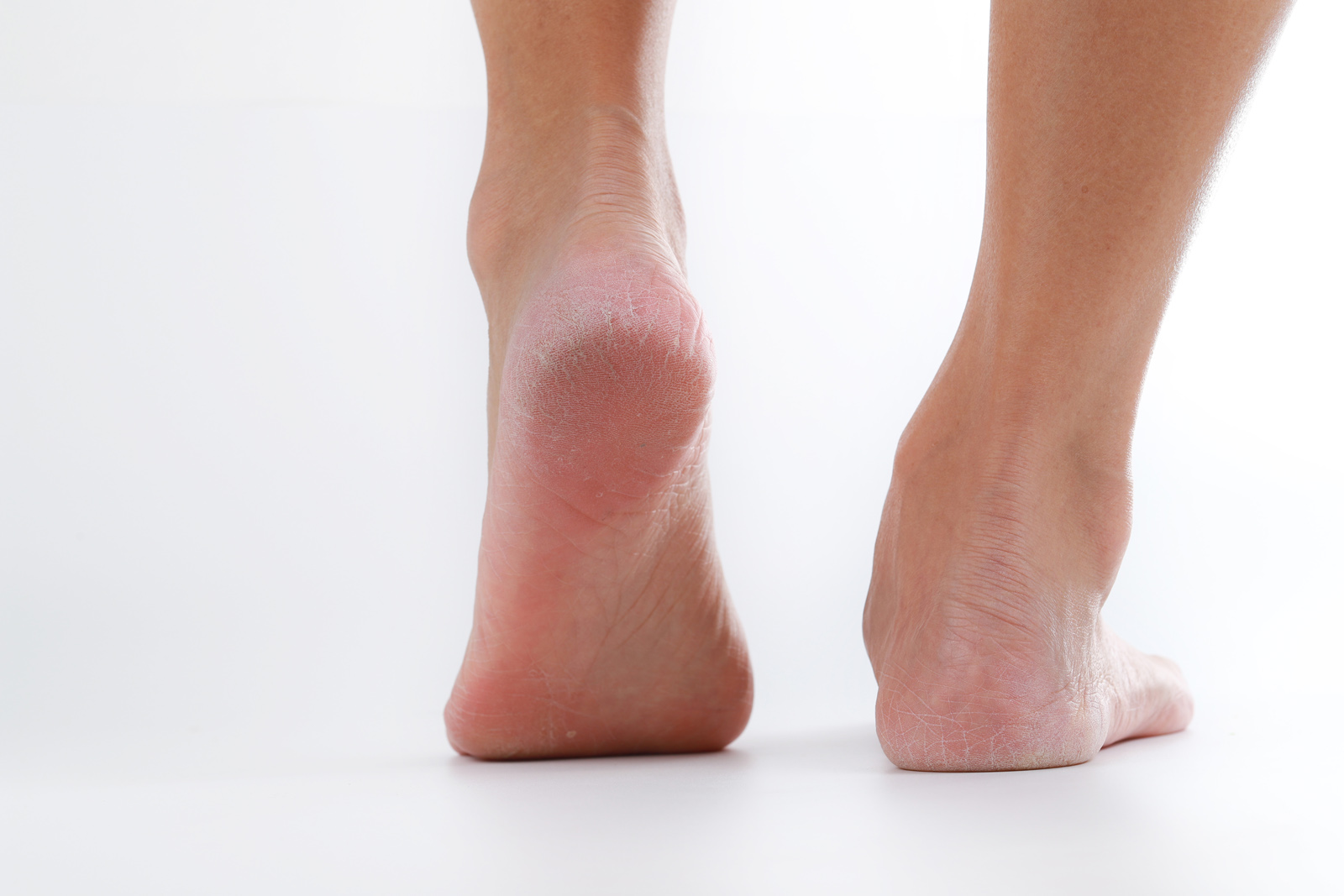 blote voeten met de achillespees in beeld.