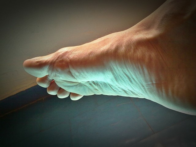 Stressfractuur
