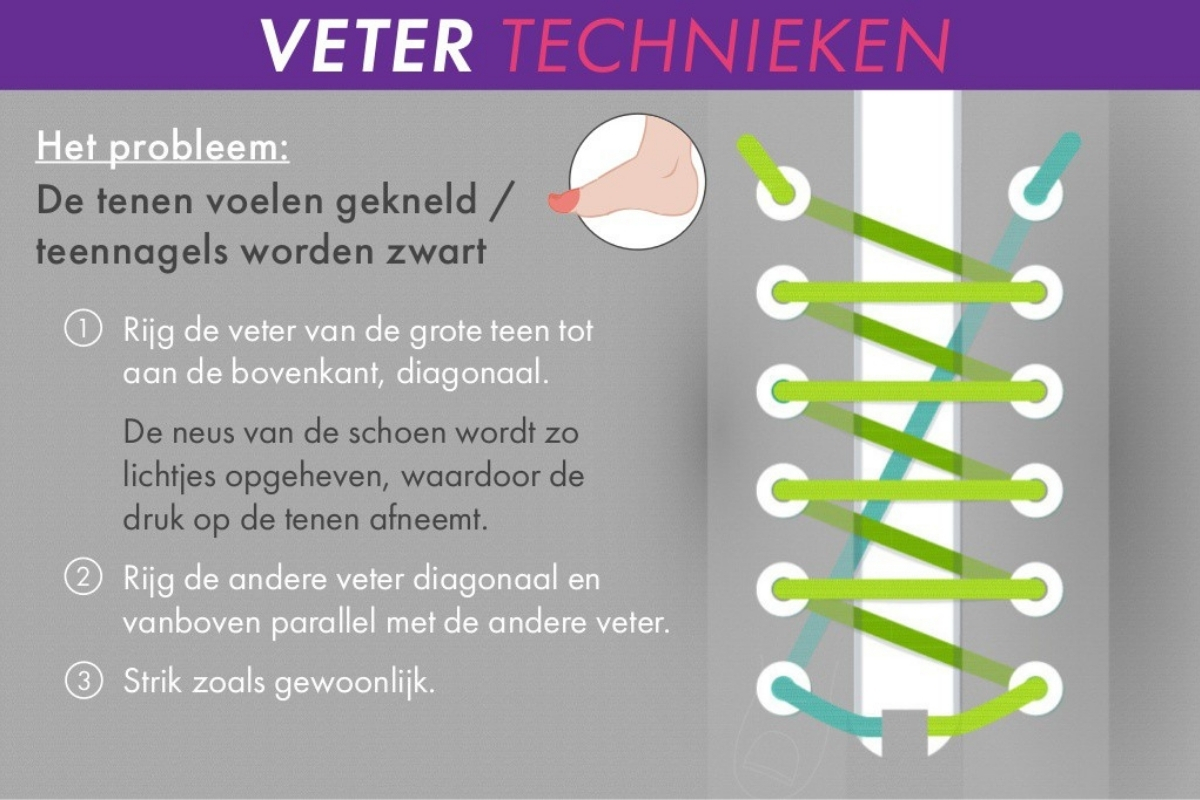 Veters Strikken Kan Voetproblemen Voorkomen Techniek 3