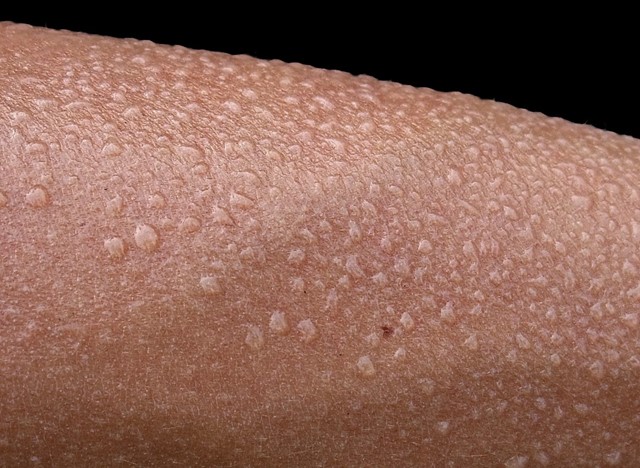 Zweetdruppels op arm | Foto: Wikimedia