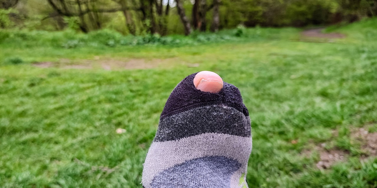 afbeelding van een teen die uit een gat in een sok komt.