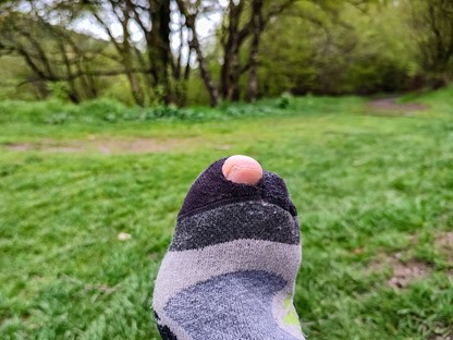 afbeelding van een teen die uit een gat in een sok komt.